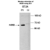 Anti-HCV NS5B antibody[5D1]