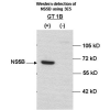Anti-HCV NS5B antibody[3E5]